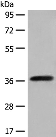 Rabbit Polyclonal Antibody to NIFK