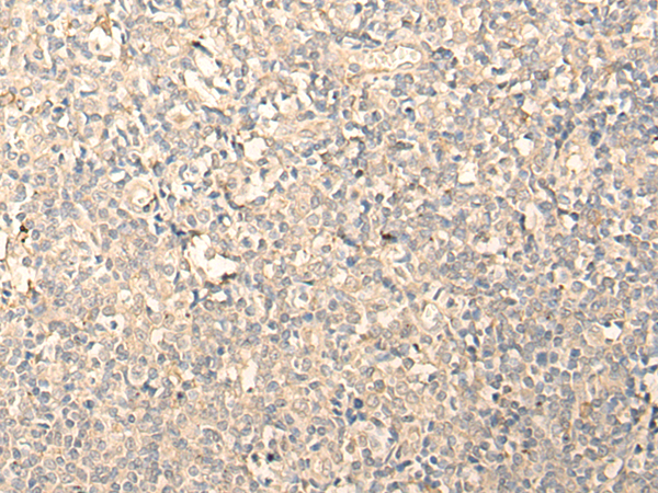 Rabbit Polyclonal Antibody to MPPED2