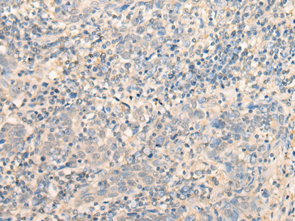 Rabbit Polyclonal Antibody to MR1
