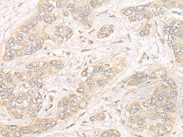 Rabbit Polyclonal Antibody to NOSIP