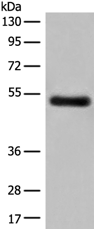 Rabbit Polyclonal Antibody to GK5