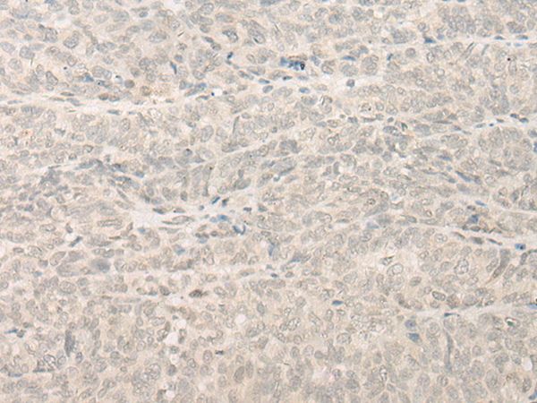 Rabbit Polyclonal Antibody to INTS11
