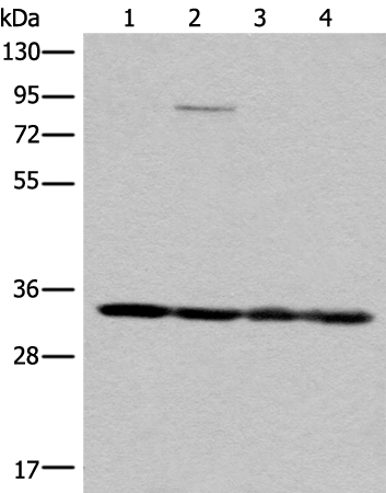 Rabbit Polyclonal Antibody to MRPL1