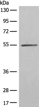 Rabbit Polyclonal Antibody to FSD1
