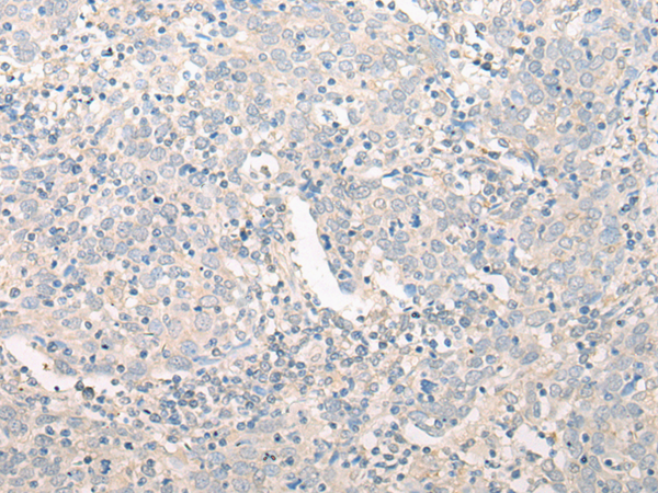 Rabbit Polyclonal Antibody to GPN2