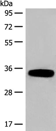 Rabbit Polyclonal Antibody to DHRS1
