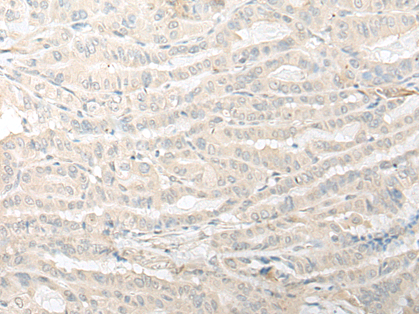 Rabbit Polyclonal Antibody to TMEM248
