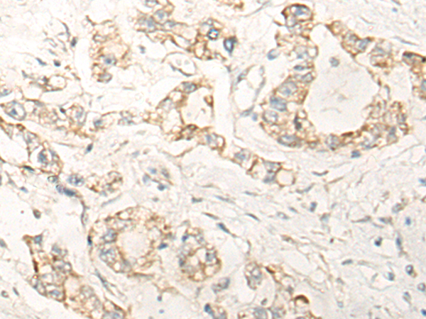 Rabbit Polyclonal Antibody to KCTD17