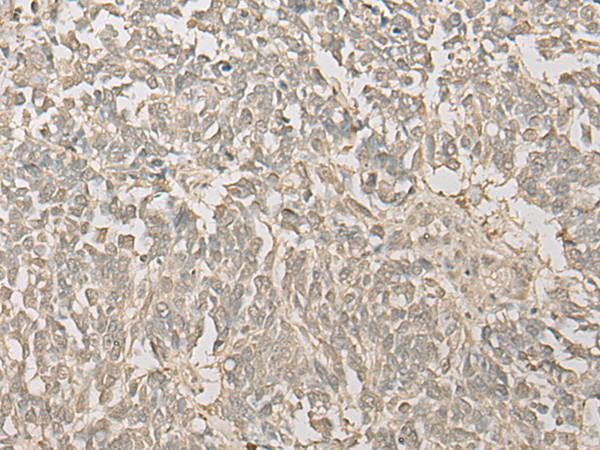 Rabbit Polyclonal Antibody to FYTTD1