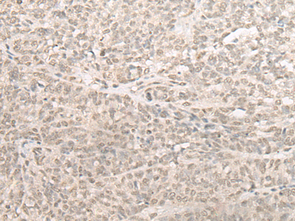Rabbit Polyclonal Antibody to SLC22A24