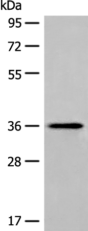 Rabbit Polyclonal Antibody to MLST8