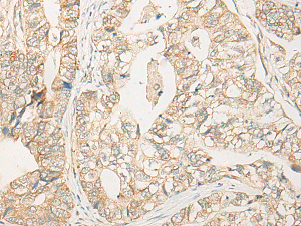 Rabbit Polyclonal Antibody to EIF2S2