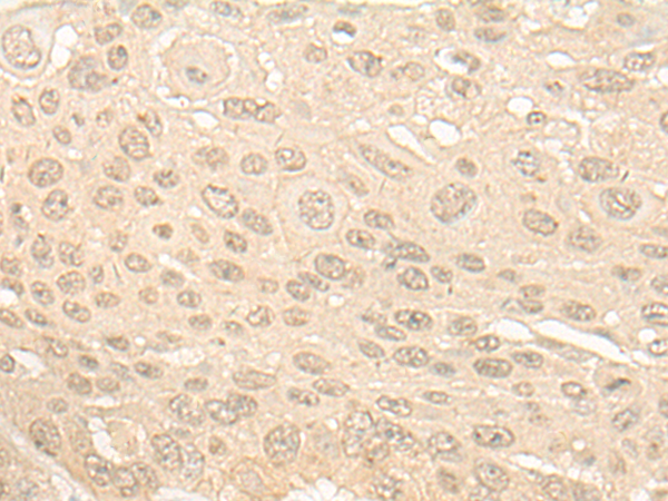 Rabbit Polyclonal Antibody to SLFN5