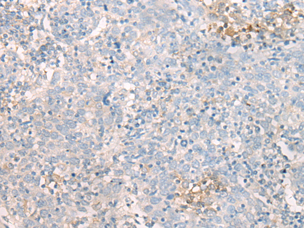 Rabbit Polyclonal Antibody to MBOAT7
