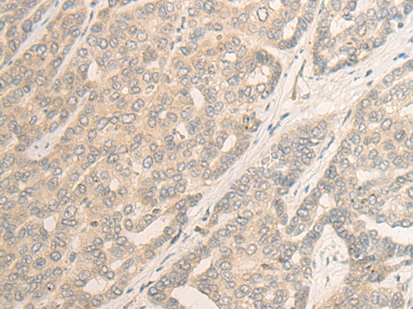 Rabbit Polyclonal Antibody to POLR1C
