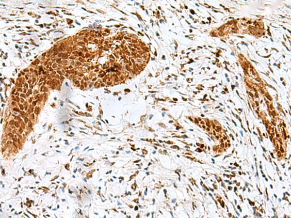 Rabbit Polyclonal Antibody to HMG20A