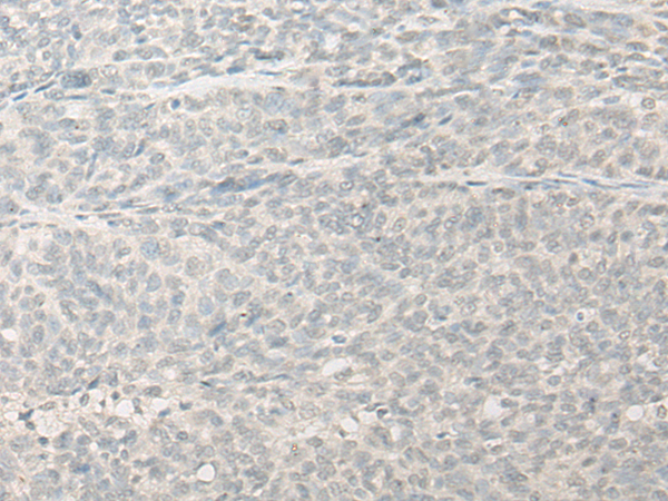 Rabbit Polyclonal Antibody to RSPH14
