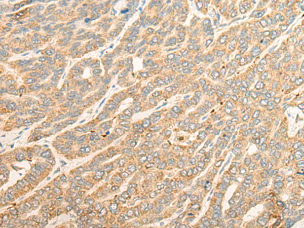 Rabbit Polyclonal Antibody to ATP6V0D1