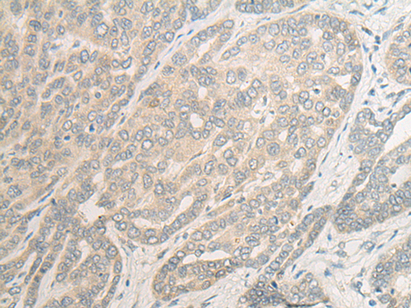Rabbit Polyclonal Antibody to A4GALT