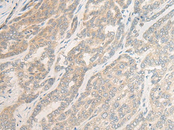 Rabbit Polyclonal Antibody to OTX1