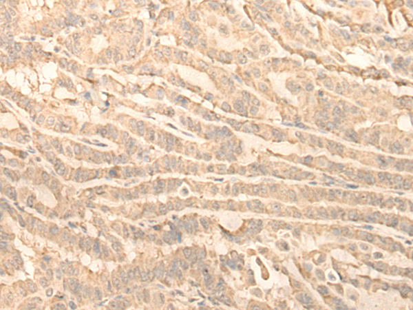 Rabbit Polyclonal Antibody to RNF146