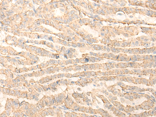 Rabbit Polyclonal Antibody to QTRT1