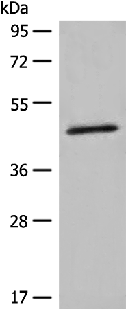 Rabbit Polyclonal Antibody to HMBS