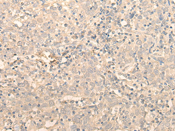 Rabbit Polyclonal Antibody to PNKD