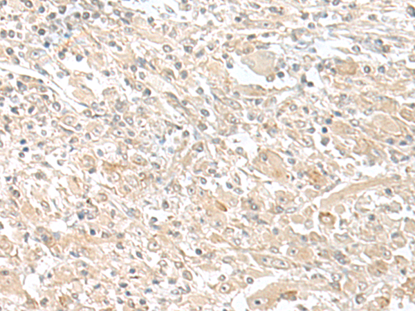 Rabbit Polyclonal Antibody to SMS