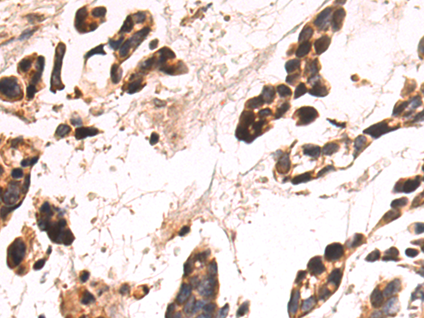 Rabbit Polyclonal Antibody to ZNF707