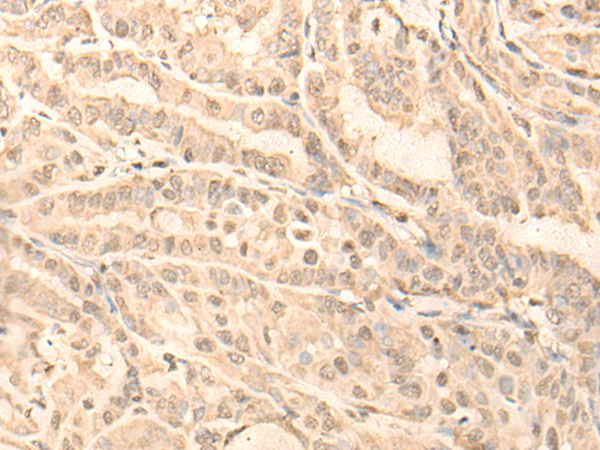 Rabbit Polyclonal Antibody to TADA3