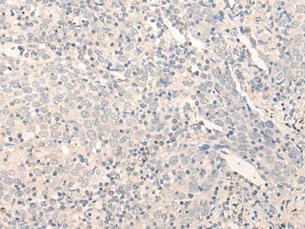 Rabbit Polyclonal Antibody to RADIL