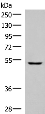 Rabbit Polyclonal Antibody to PISD