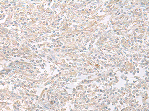 Rabbit Polyclonal Antibody to ERGIC3