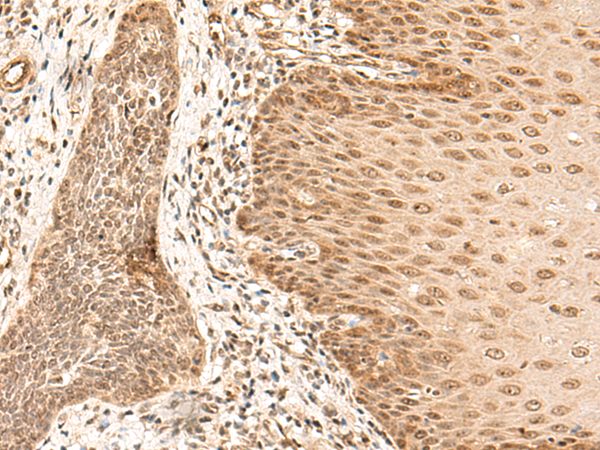 Rabbit Polyclonal Antibody to ARMC8