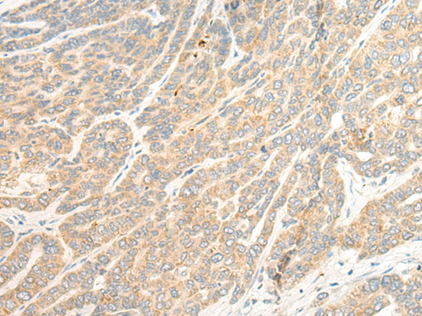 Rabbit Polyclonal Antibody to TTC4