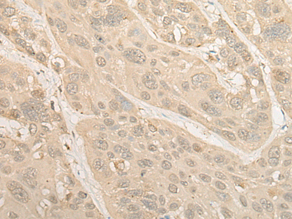 Rabbit Polyclonal Antibody to PSMC4