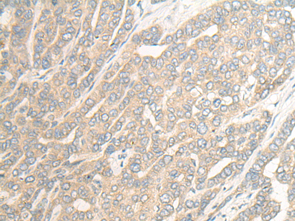 Rabbit Polyclonal Antibody to DGAT2
