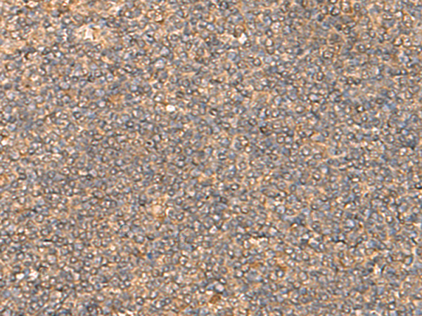 Rabbit Polyclonal Antibody to DNAJC14