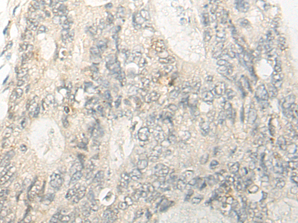 Rabbit Polyclonal Antibody to PSMC6