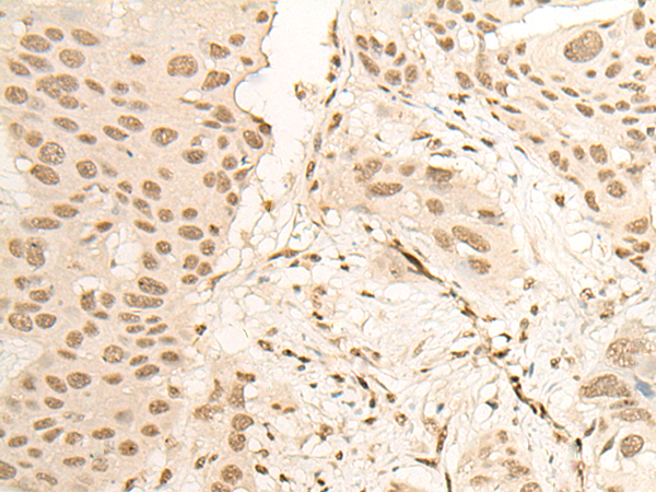 Rabbit Polyclonal Antibody to NEIL1