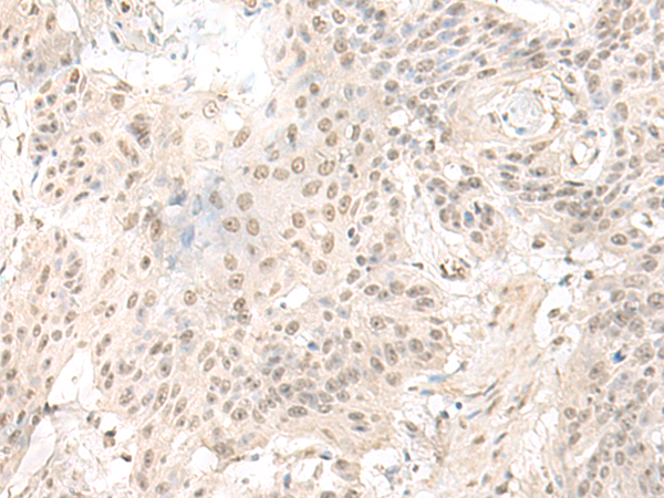 Rabbit Polyclonal Antibody to ILKAP