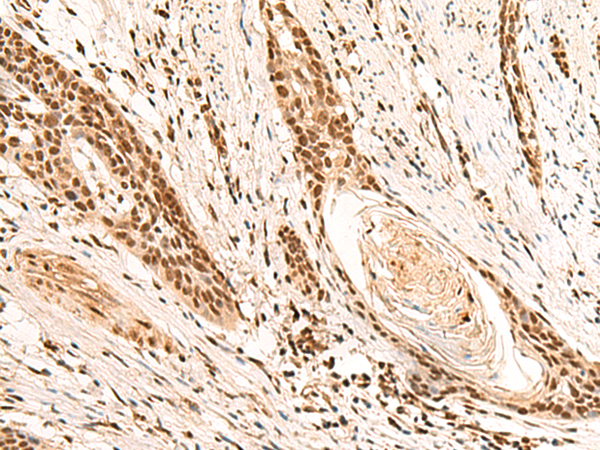 Rabbit Polyclonal Antibody to RMND5B