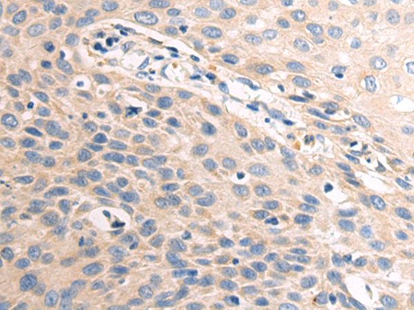 Rabbit Polyclonal Antibody to TCN2