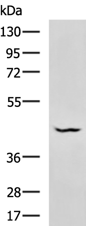 Rabbit Polyclonal Antibody to RBM17