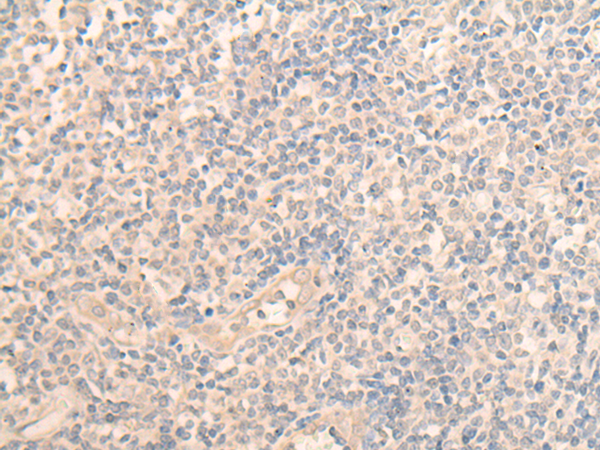 Rabbit Polyclonal Antibody to PLEKHA1