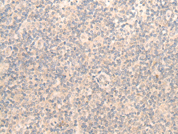 Rabbit Polyclonal Antibody to OLFML3