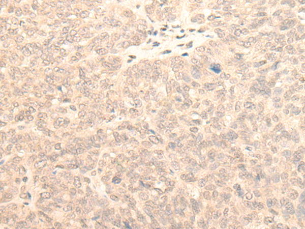 Rabbit Polyclonal Antibody to KLHDC2