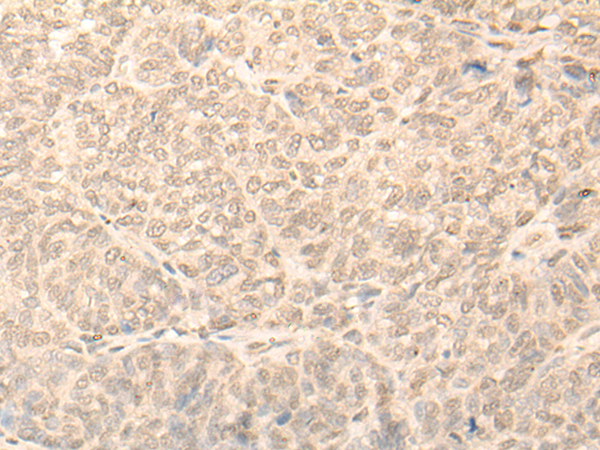 Rabbit Polyclonal Antibody to NARF