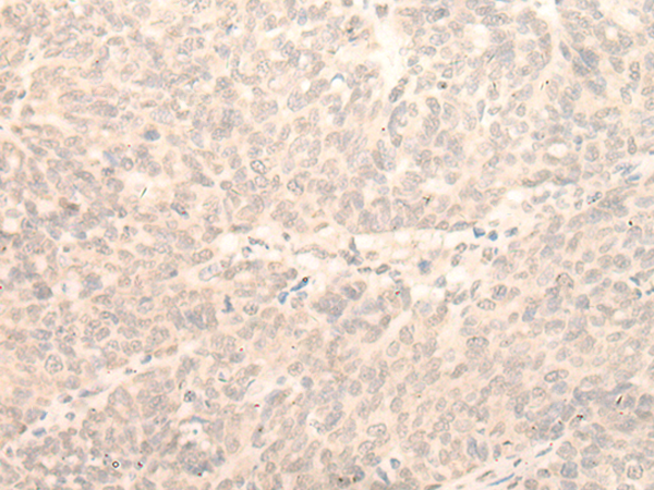 Rabbit Polyclonal Antibody to RAD23B